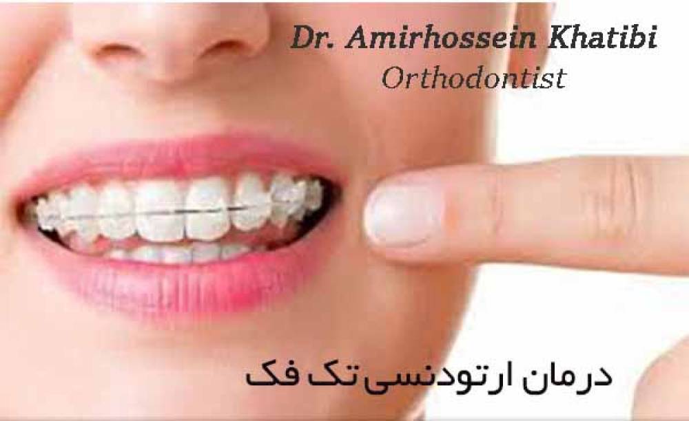 ارتودنسی تنها یک فک یا ارتودنسی ثابت دو فک