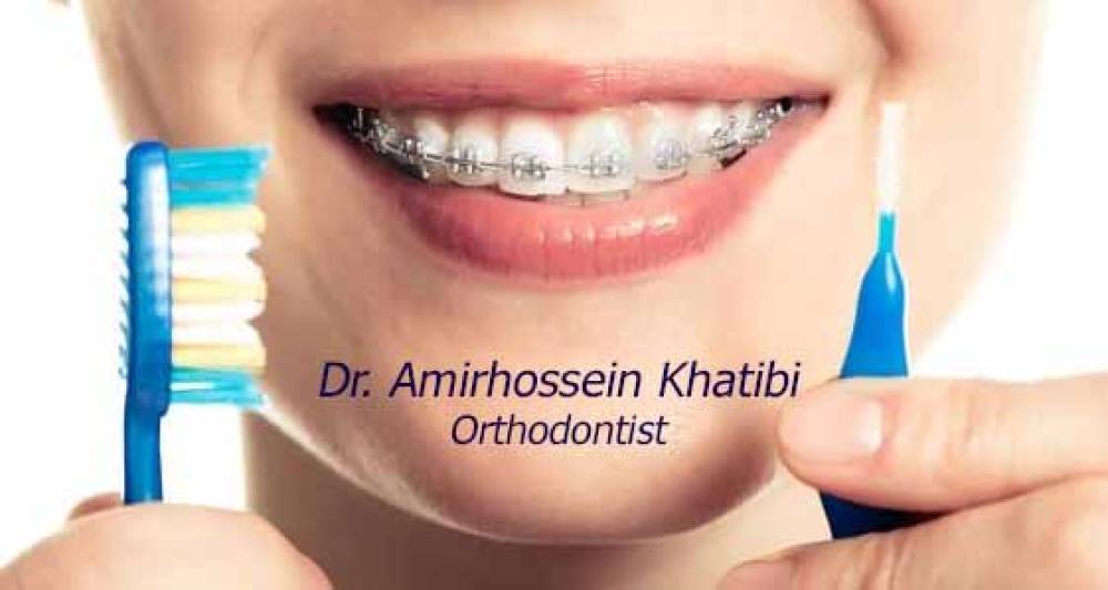 مسواک بین دندانی ارتودنسی