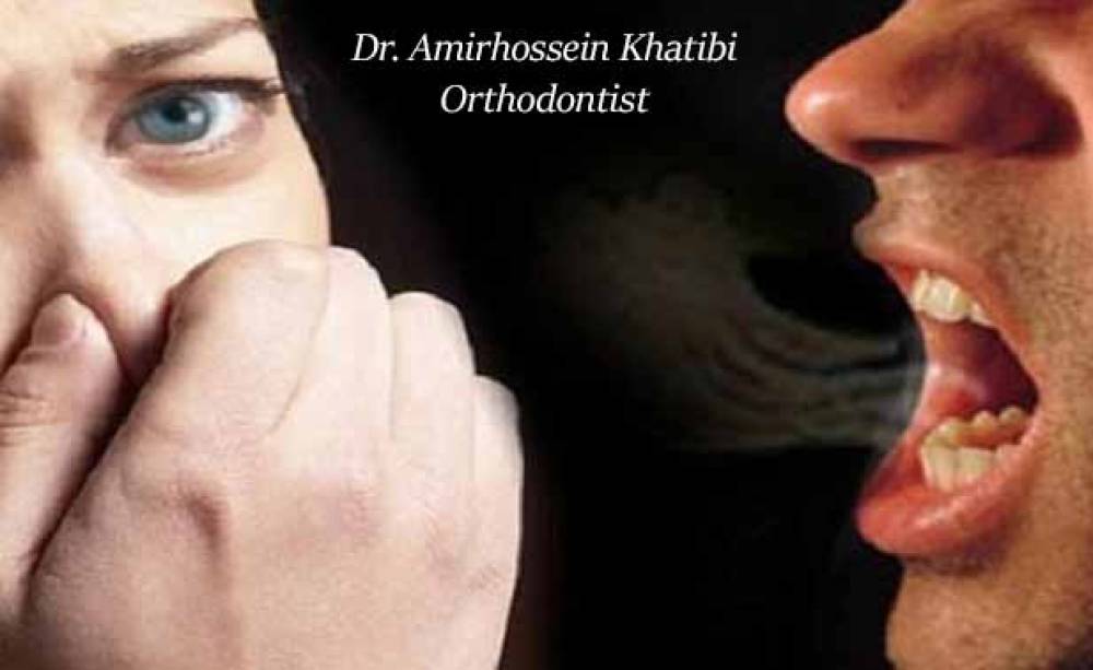 بوی بد دهان