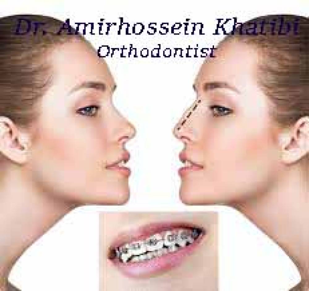 ارتودنسی همزمان با عمل جراحی بینی