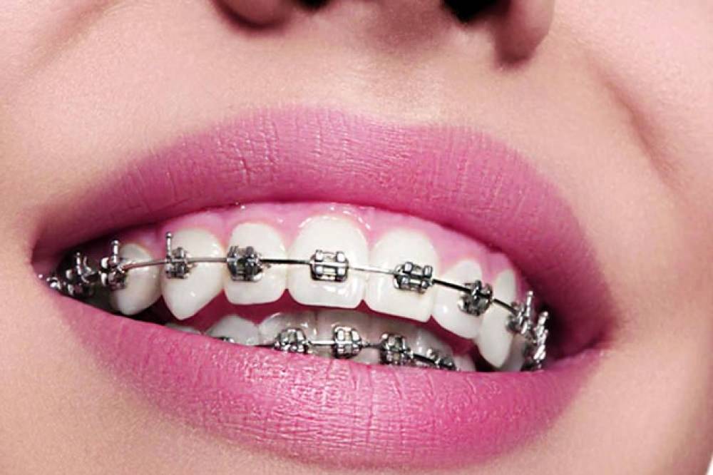 ارتودنسی در رباط کریم و متخصص ارتودنسی در رباط کریم
